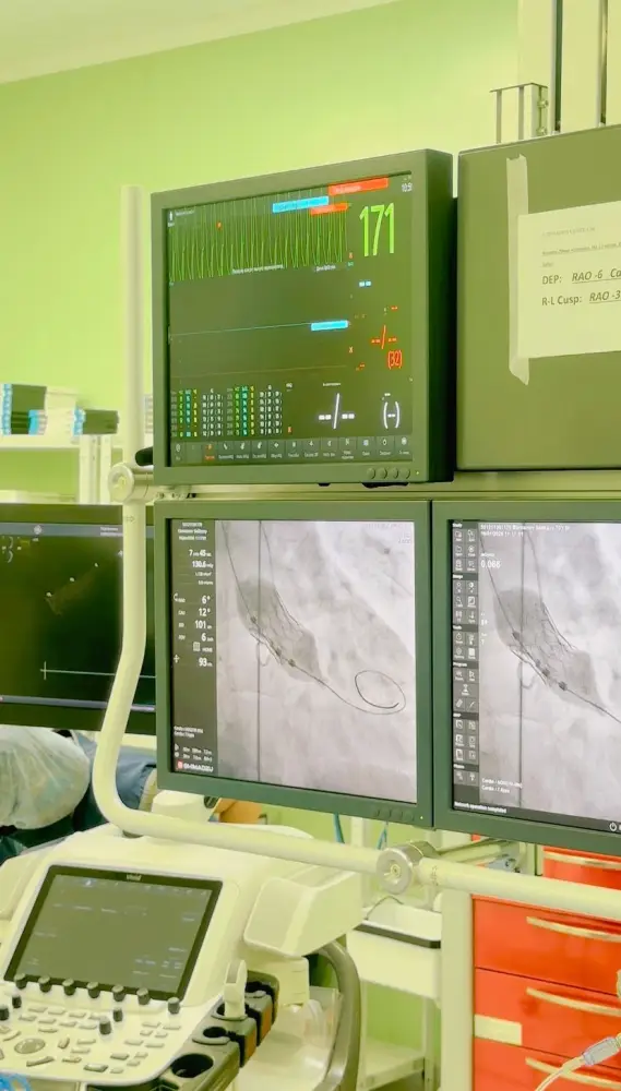 Высокие технологии в кардиологии: в Алматы пожилым пациентам заменили клапан сердца (3)