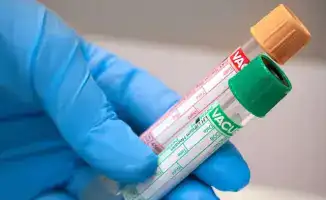 Освобождение предпринимателей: влияние антимонопольного вмешательства на рынок лабораторных услуг